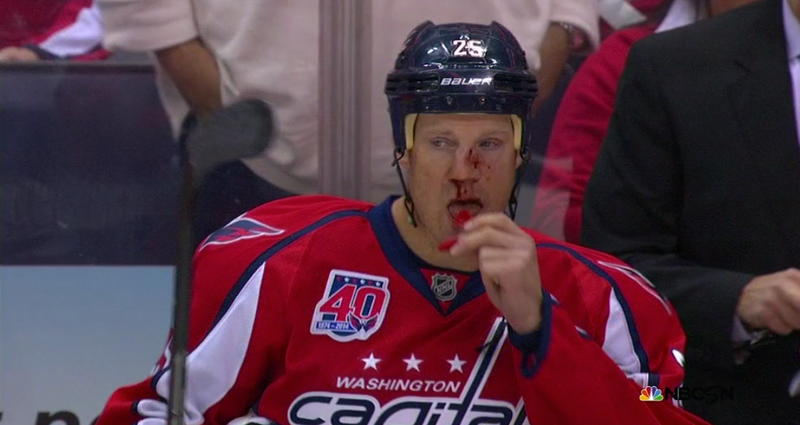 Illustration for article titled Jason Chimera's Nose Got Toasted Last Night